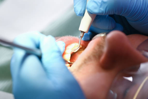 Best Emergency Gum Treatment in Nesconset, NY