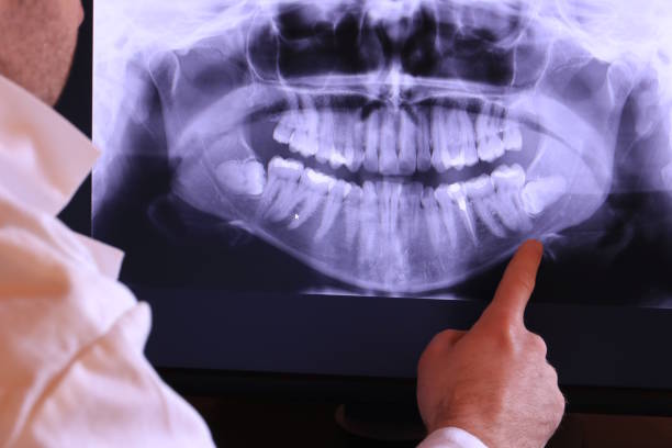 Best Emergency Dental Care for Broken or Chipped Teeth in Nesconset, NY
