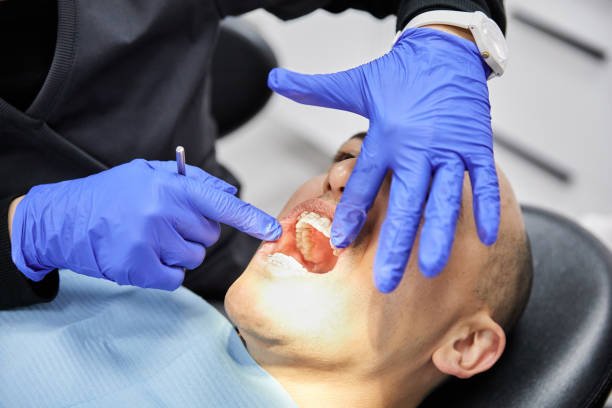 Best Emergency Treatment for Dental Infections or Abscesses in Nesconset, NY